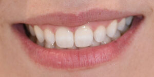 Prevenzione orale Capoterra