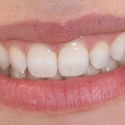 Prevenzione orale Capoterra