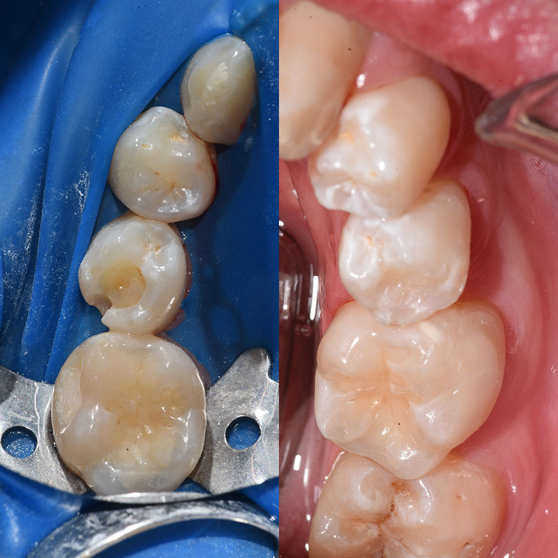 Prevenzione orale pre e post trattamento