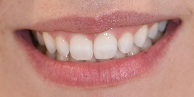 Prevenzione orale Capoterra